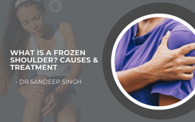 What is a Frozen Shoulder? Causes & Treatment