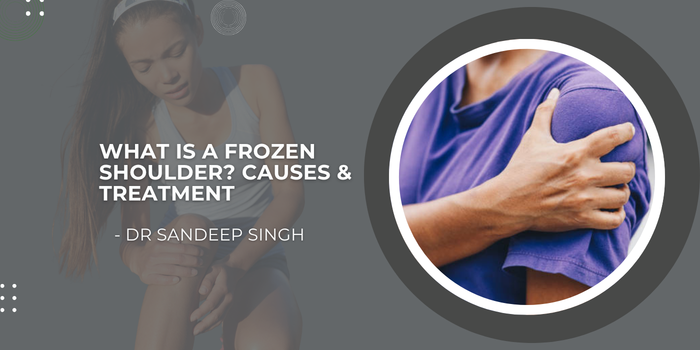 What is a Frozen Shoulder Causes Treatment