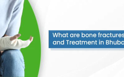 What are bone fractures: Types and Treatment in Bhubaneswar