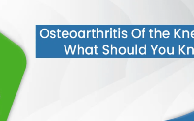 Osteoarthritis Of the Knee Joint – What Should You Know?