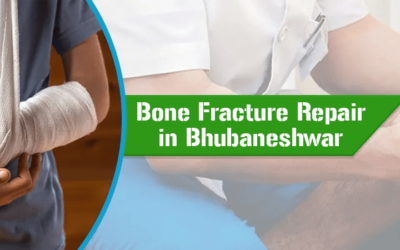 Everything You Need To Know About Bone Fracture Repair