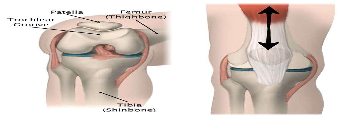 RECOVERY FROM KNEE PAIN