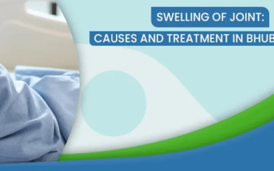 Swelling of Joint: Causes and Treatment in Bhubaneswar