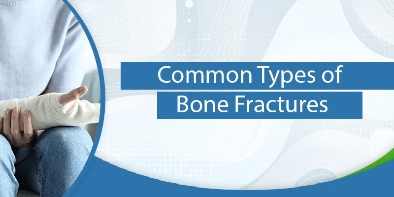 common Types of bone fractures