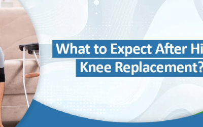 What to Expect After Hip or Knee Replacement