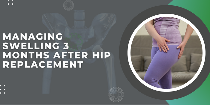 Managing Swelling 3 Months After Hip Replacement