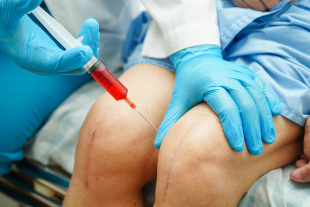 Treatment Options for Fluid on the Knee After Knee Replacement