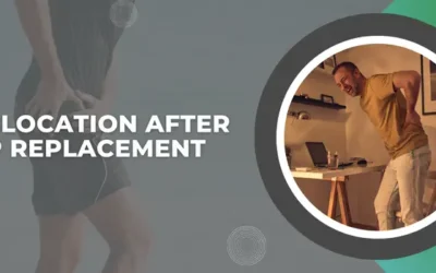 Dislocation after Hip Replacement