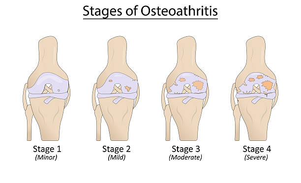 Stages