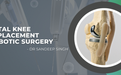 Total Knee Replacement Robotic Surgery