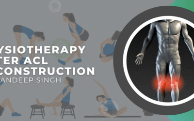 Physiotherapy After ACL Reconstruction – Dr. Sandeep Singh’s Guide