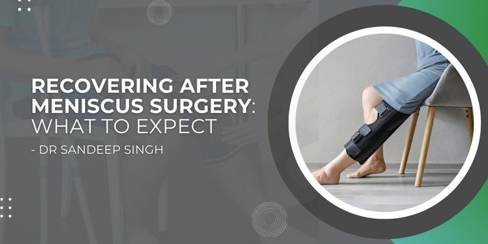 Recovery after Meniscus Surgery