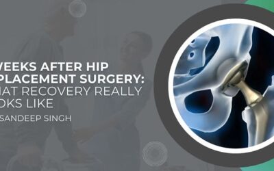 3 Weeks After Hip Replacement Surgery: What to Expect & Recovery Tips