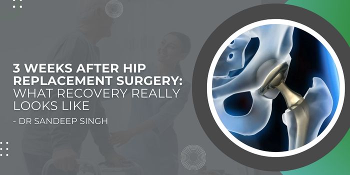 3 Weeks After Hip Replacement Surgery