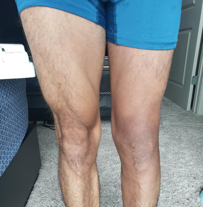 Picture12 - Dr Sandeep Singh