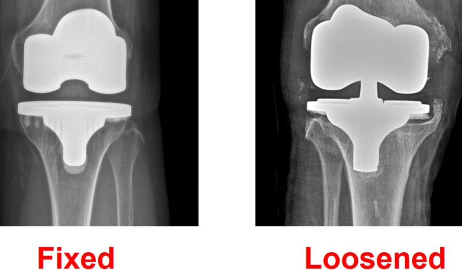 Picture7 - Dr Sandeep Singh