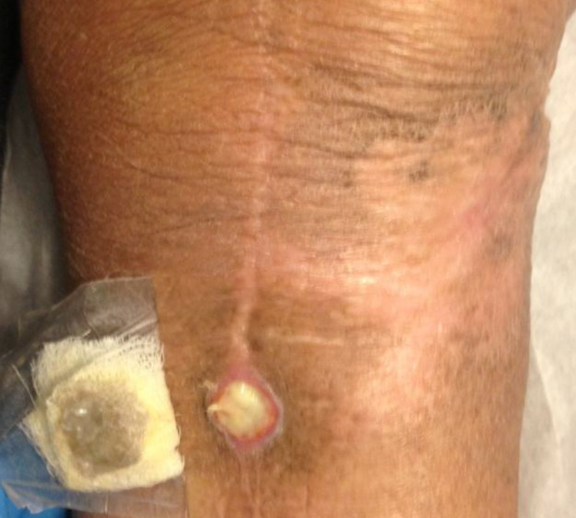 Picture8 - Dr Sandeep Singh