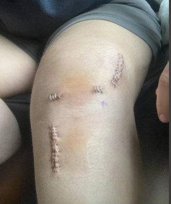 Picture9 - Dr Sandeep Singh