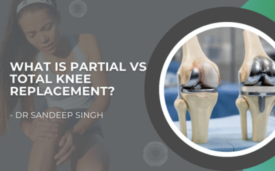 What is Partial vs Total Knee Replacement?