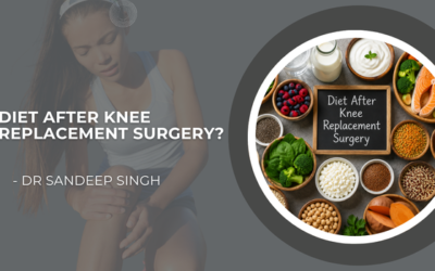 Diet After Knee Replacement Surgery?