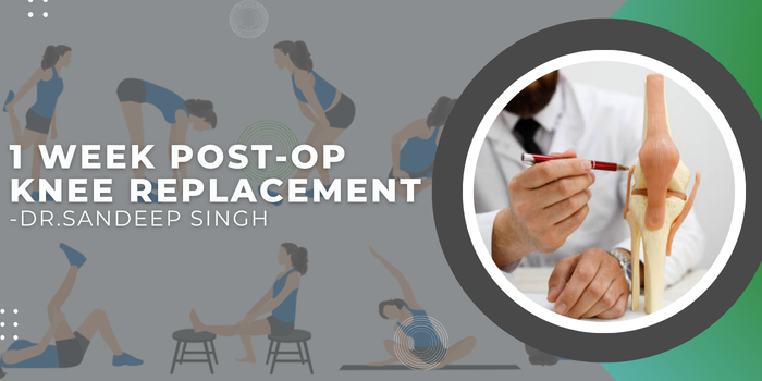 Banner announcing 1 week post-op knee replacement with background exercise illustrations and a circular inset of a clinician examining a knee model on the right