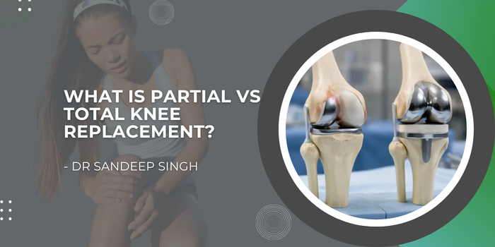 What is Partial vs Total Knee Replacement