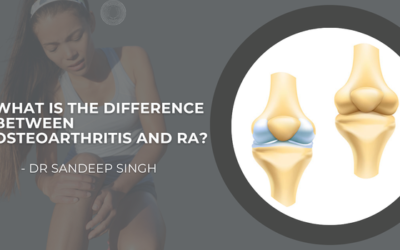 What is the Difference Between Osteoarthritis and RA?