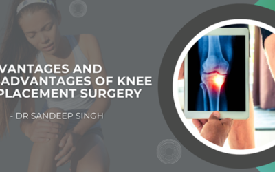 Advantages and Disadvantages of Knee Replacement Surgery