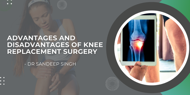 Informational banner about the advantages and disadvantages of knee replacement surgery with a knee X-ray shown on a tablet and by Dr. Sandeep Singh.