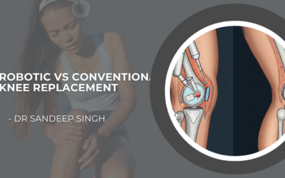 Robotic vs Conventional Knee Replacement