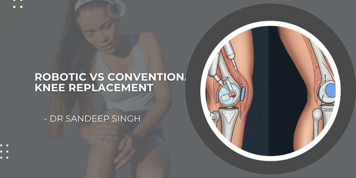 Robotic vs Conventional Knee Replacement | Dr. Sandeep Singh