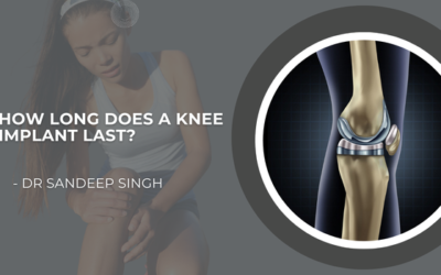 How Long Does a Knee Implant Last?