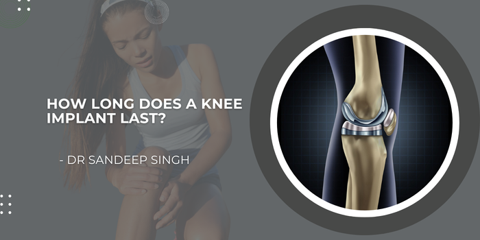 How Long Does a Knee Implant Last | Dr. Sandeep Singh