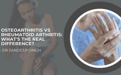 Osteoarthritis vs Rheumatoid Arthritis: What’s the Real Difference?