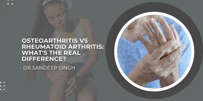 Osteoarthritis vs Rheumatoid Arthritis Whats the Real Difference