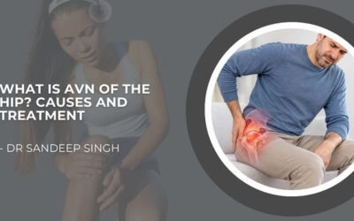 What Is AVN of the Hip? Causes and Treatment