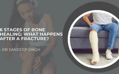 6 Stages of Bone Healing: What Happens After a Fracture?