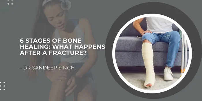Educational graphic on six stages of bone healing; person with injured leg on the left and a casted leg in a circular frame on the right.