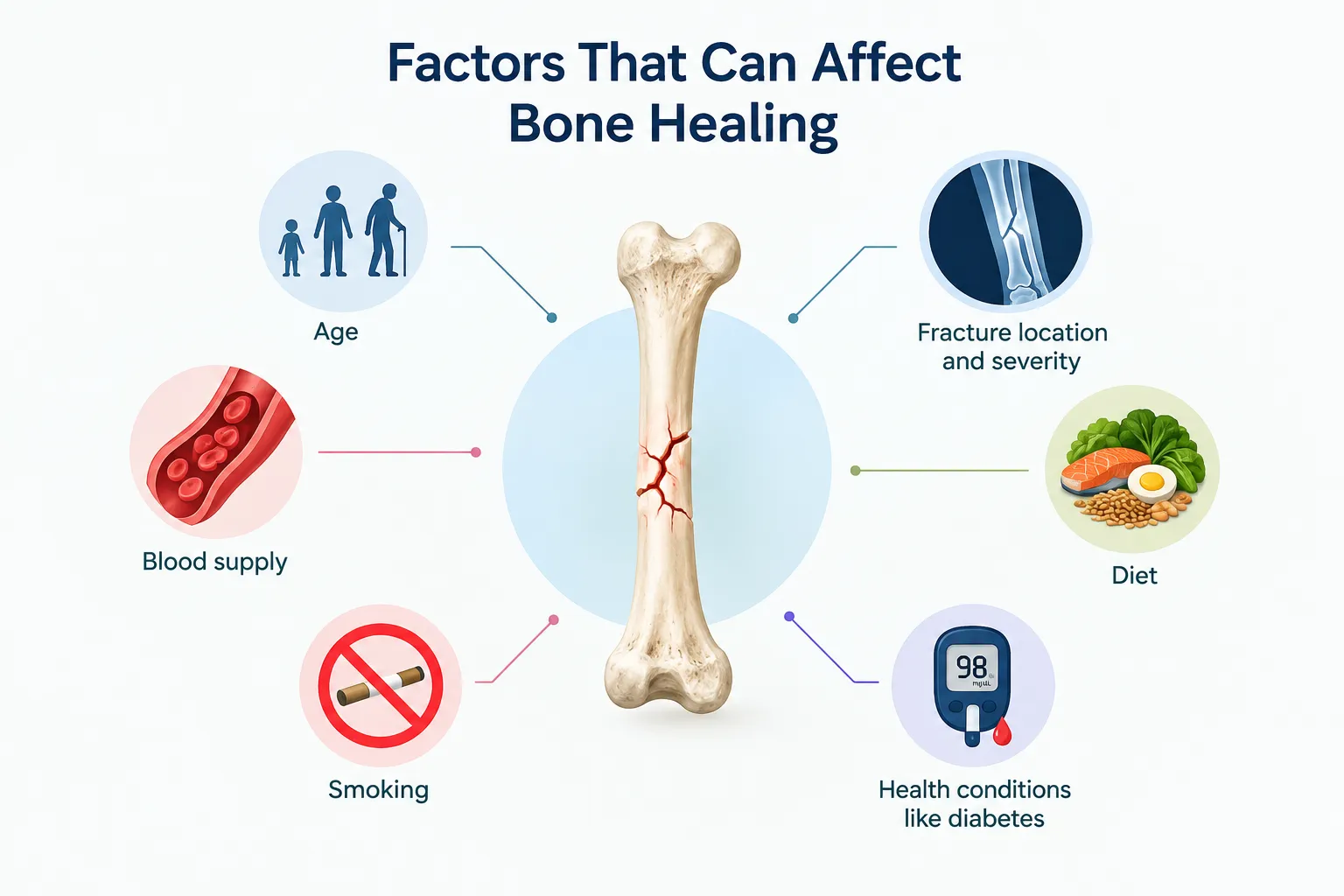 Infographic listing factors that affect bone healing: age, fracture location/severity, diet, blood supply, smoking, and diabetes.